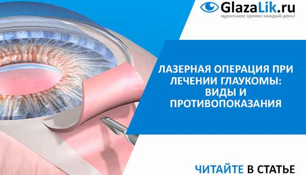 лазерное лечение глаукомы